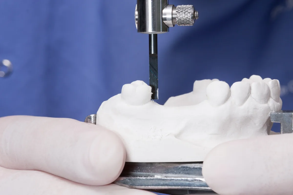 A dental model being shaped in the laboratory